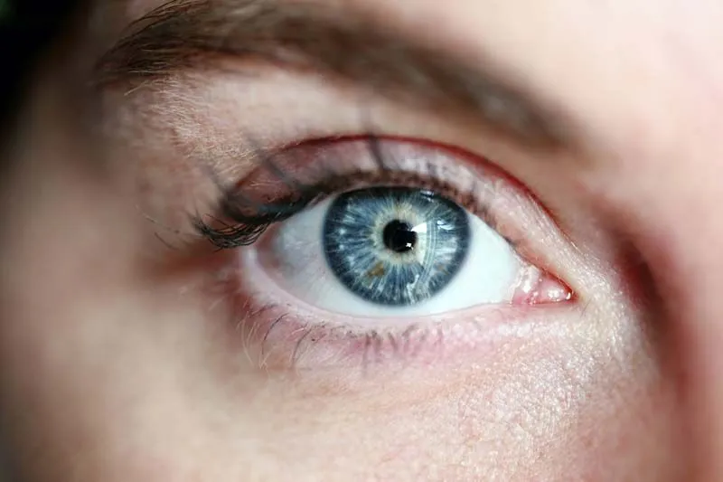 Ojo con lente de contacto